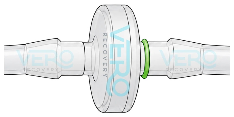Fitting the one-way valve in the middle of the two hoses